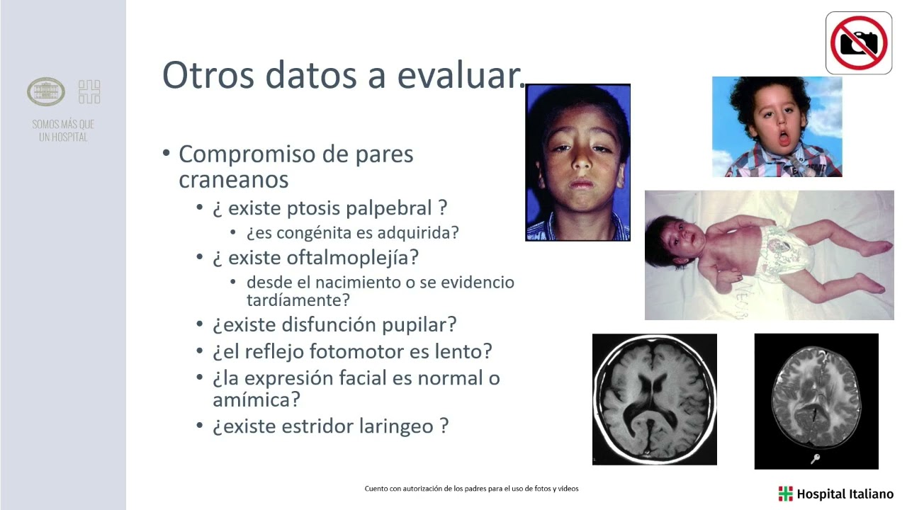 Clinica y diagnóstico de AME