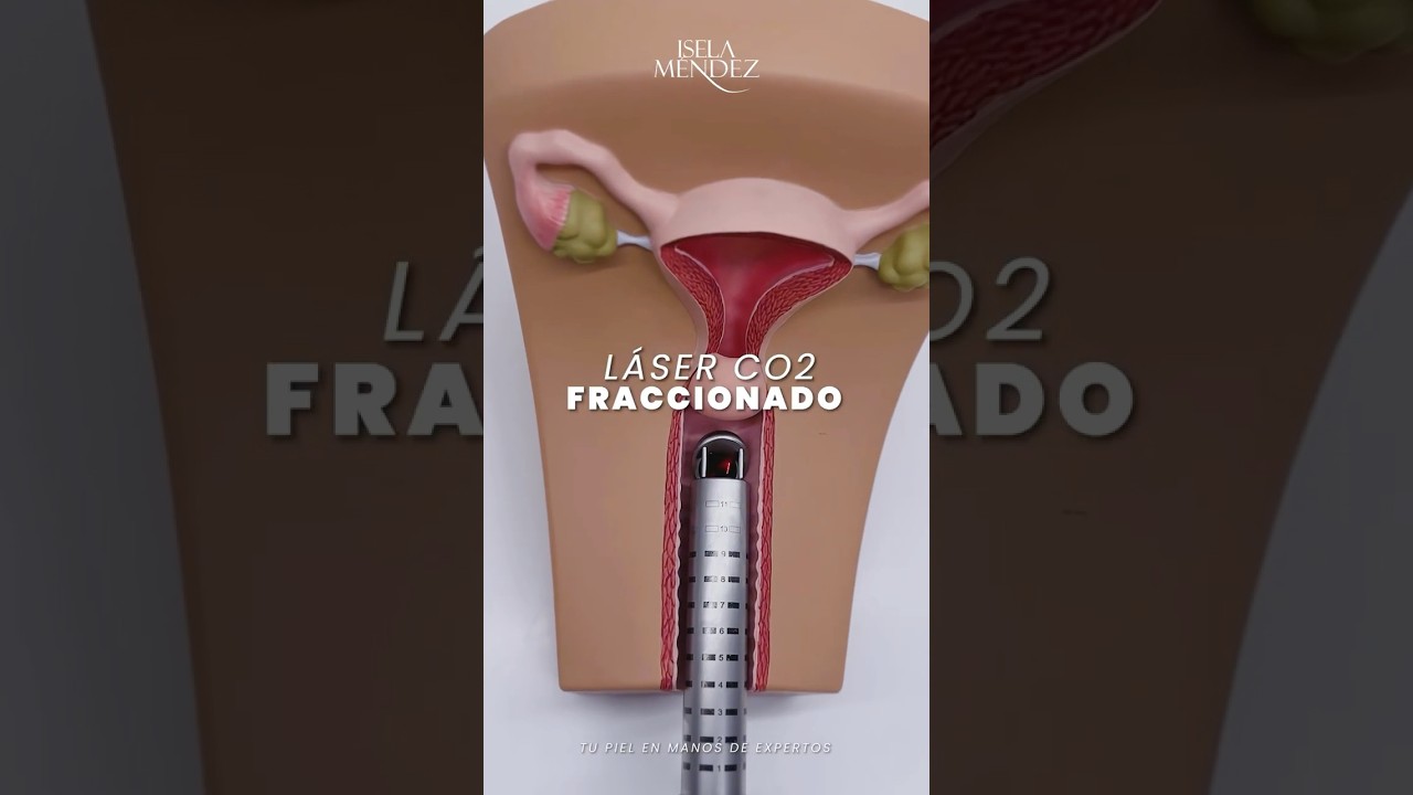 ¡Rejuvenecimiento íntimo! ✨👩🏻‍⚕️