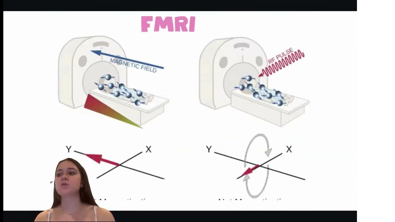Schizophrenia in FMRIs