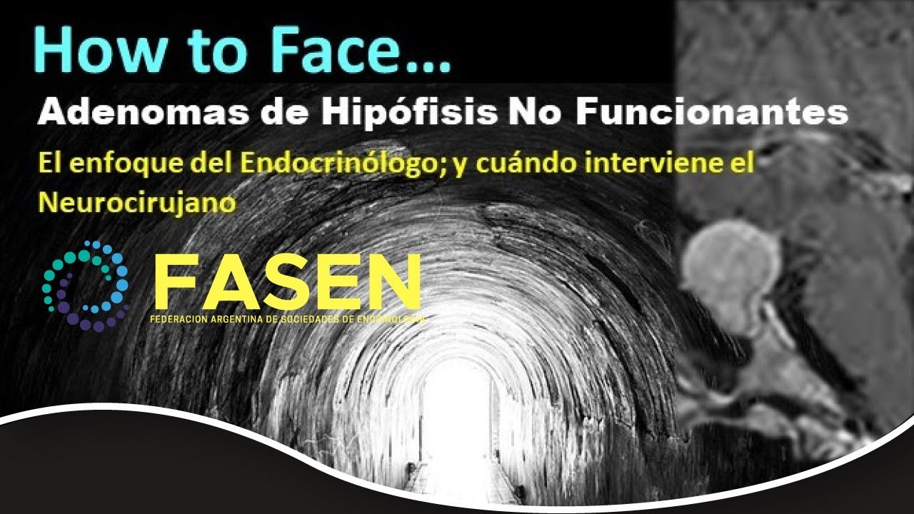 Ateneo FASEN. Adenomas No funcionantes de Hip&oacute;fisis