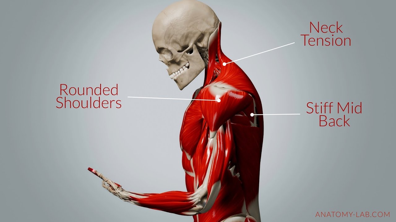 How Your Phone Is Changing Your Posture
