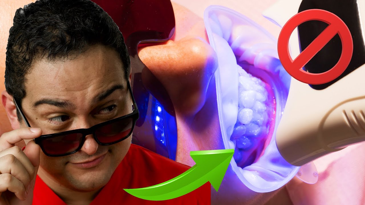 BLANQUEAMIENTO DENTAL: ¡CUIDADO CON LAS LAMPARAS PARA BLANQUEAR LOS DIENTES! ¡NO LO HAGAS!