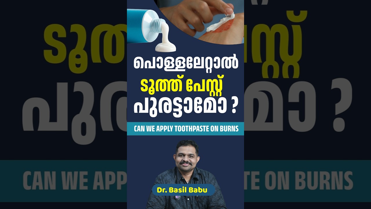 Can we apply toothpaste on burns |  DR BASIL BABU
