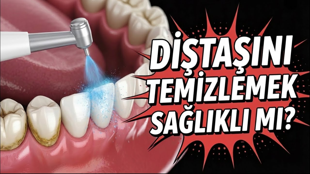 Dişeti Sağlığı: Diş Taşı Neden Oluşur ve Nasıl Önlenir? / Dr. Volkan Aykaç / Aykaçdiş
