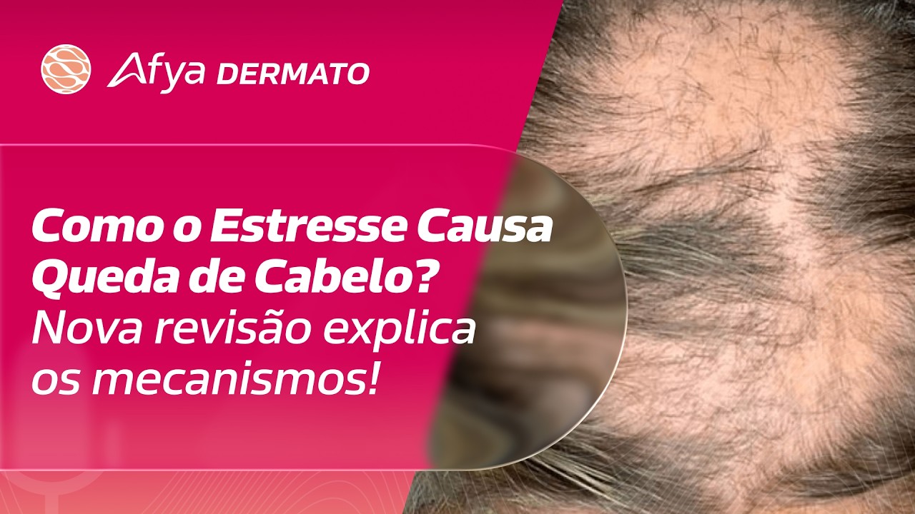 Como o Estresse Causa Queda de Cabelo? Nova Revisão Explica os Mecanismos