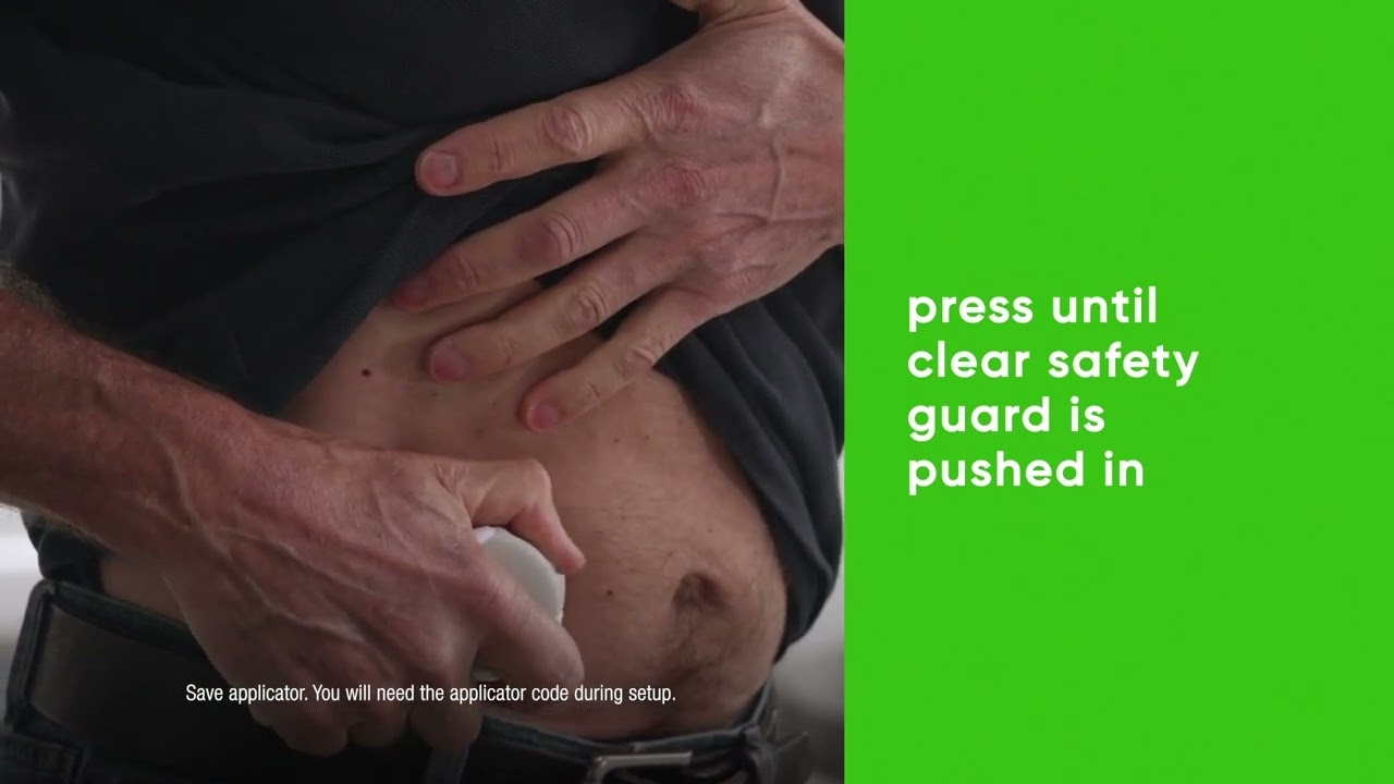 G7 Sensor Insertion  Abdomen video OUS