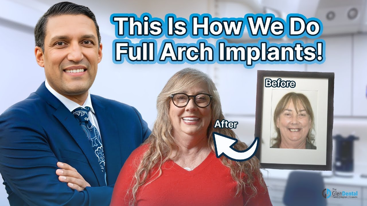 Did you know a dental implant can last longer than your car, your phone, and even some relationships