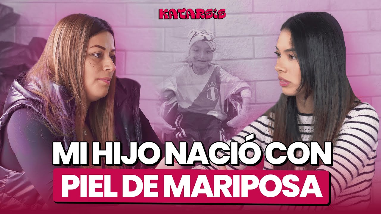 Mi hijo con PIEL DE MARIPOSA es viral en redes - Apoyemos a Patrick con Anghie - Katarsis