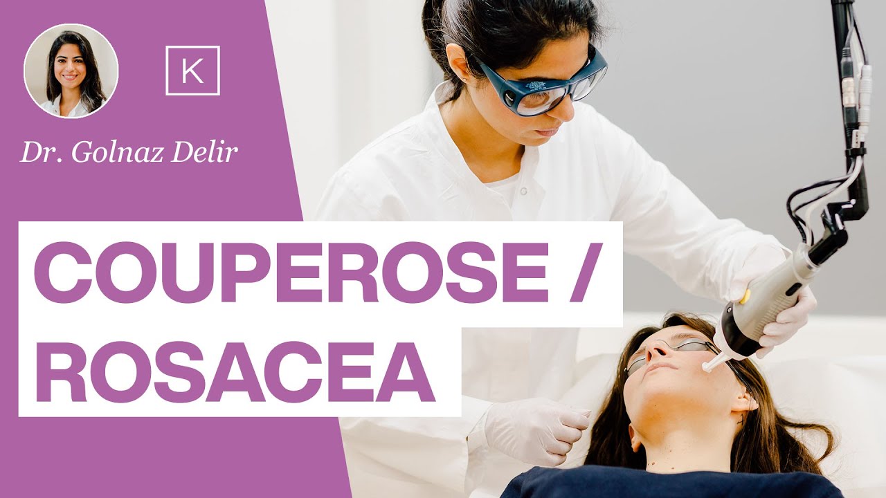 Rosacea / Couperose: Was ist das und was kann ich dagegen tun? - Dr. Golnaz Delir erklärt