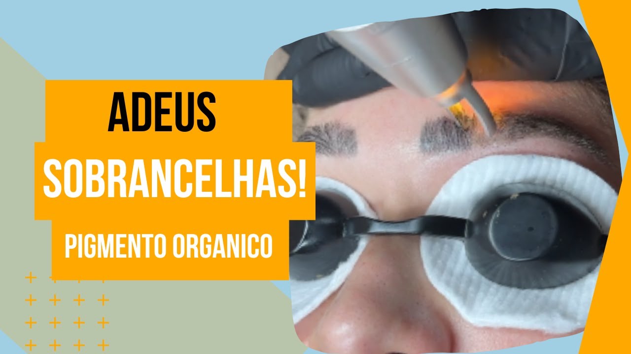 Adeus Pigmento Orgânico: Como Removi uma Sobrancelha de 4 Anos com Laser!