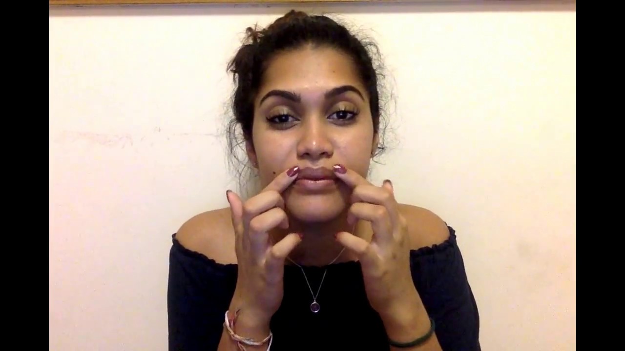 Double Jaw Surgery - My Experience | 6 weeks post-op