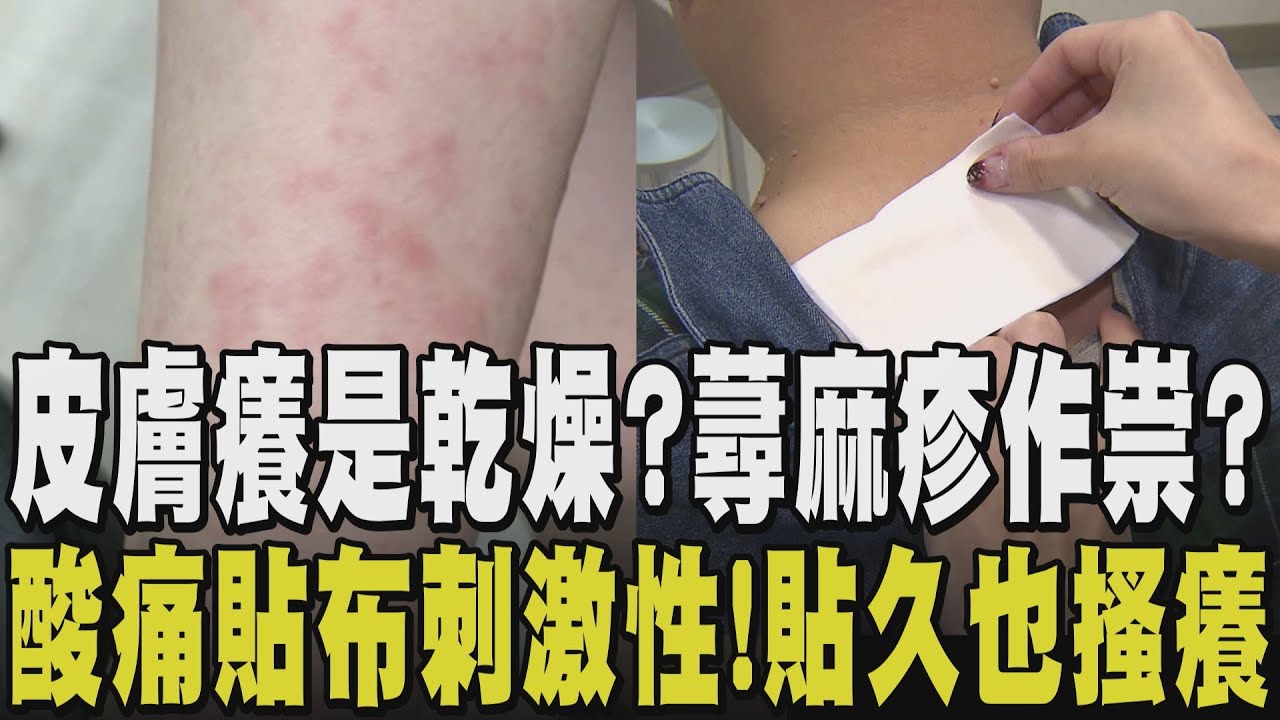 冬天到了癢癢症也來了？皮膚膨疹.莫名搔癢速就醫 恐是急性蕁麻疹作祟  也可能是腫瘤警訊 貼痠痛貼布搔癢速撕掉！刺激性成分悶住恐加劇症狀｜【話題懶人包】｜TVBS新聞@TVBSNEWS02