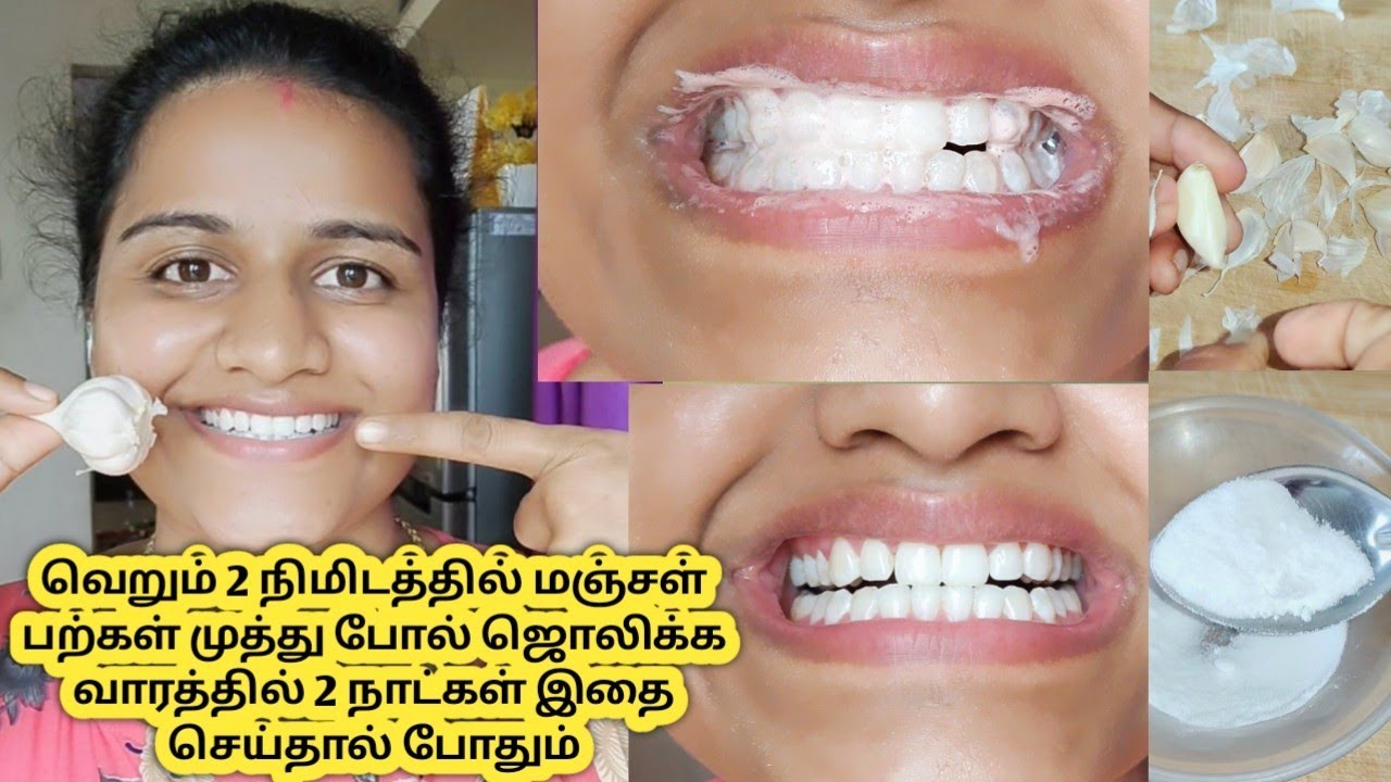 வெறும் 2 நிமிடத்தில் மஞ்சள் பற்களை வெள்ளை‌ பற்களாக மாற்ற வாரத்தில் 2 நாட்கள் செய்தால் போதும்