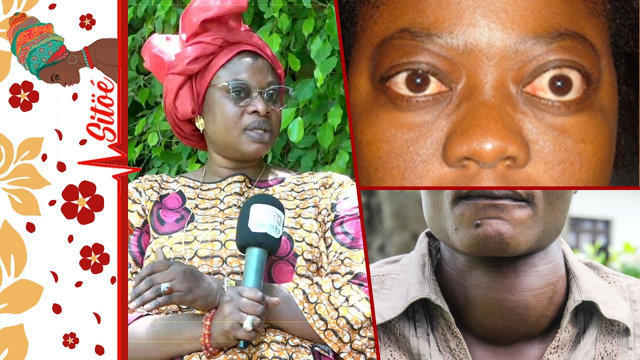 Focus avec Ndéye Sène celle qui porte le combat contre le goitre, basedow, thyroïdite
