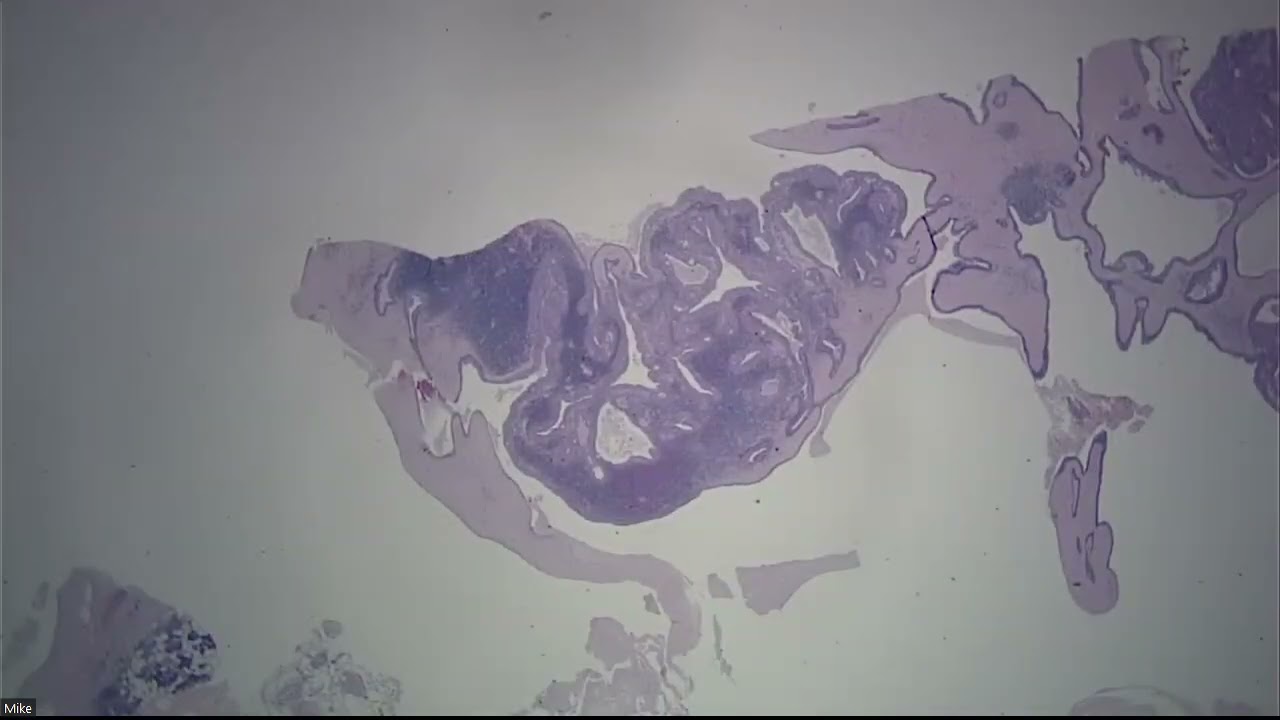 ENT Salivary Frozens Day 2 2023 03 02