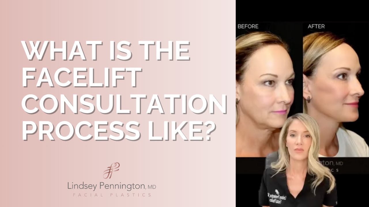 Dr.Pennington Talks About the Facelift Consultation Process #facialplasticsurgery