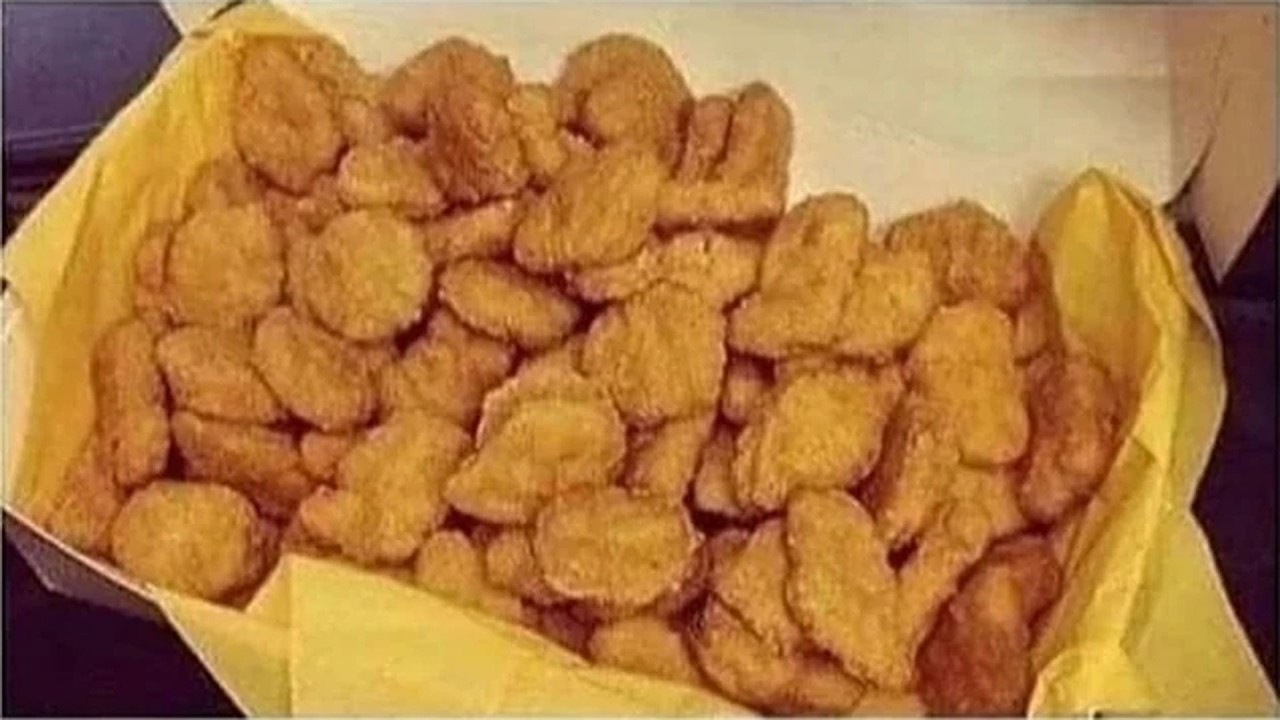 A Boy Ate 75 Chicken Nuggets Everyday For 7 Years. This Is What Happened To His Eyes.