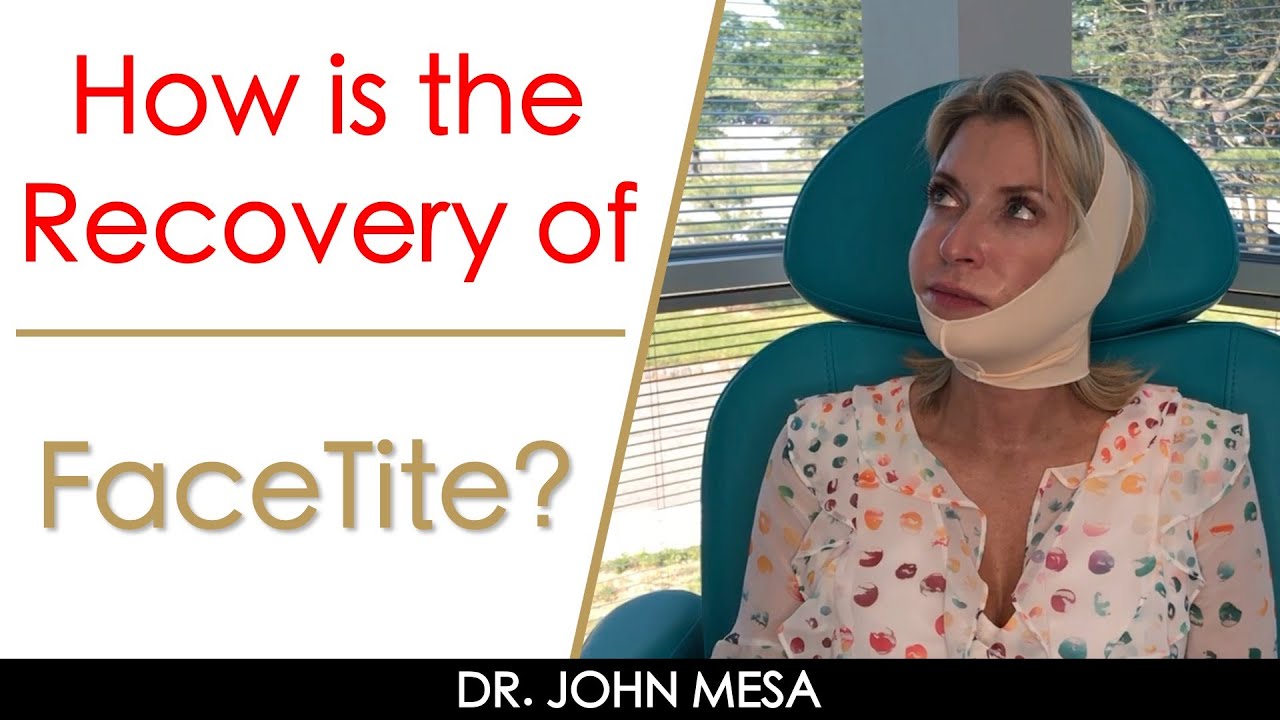 How is the Recovery of FaceTite? | Q&A By Dr. Mesa!