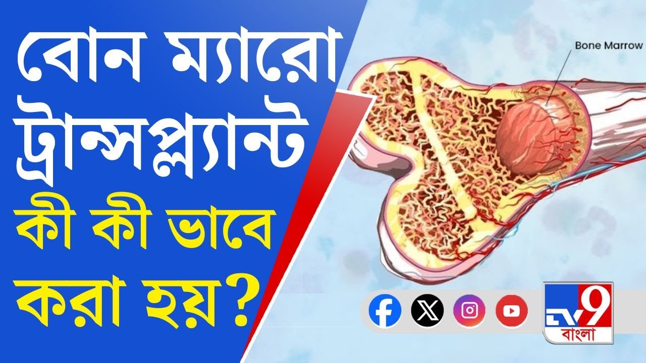 Bone Marrow Transplant: শরীরের রক্তকণিকা তৈরি করে অস্থিমজ্জা!