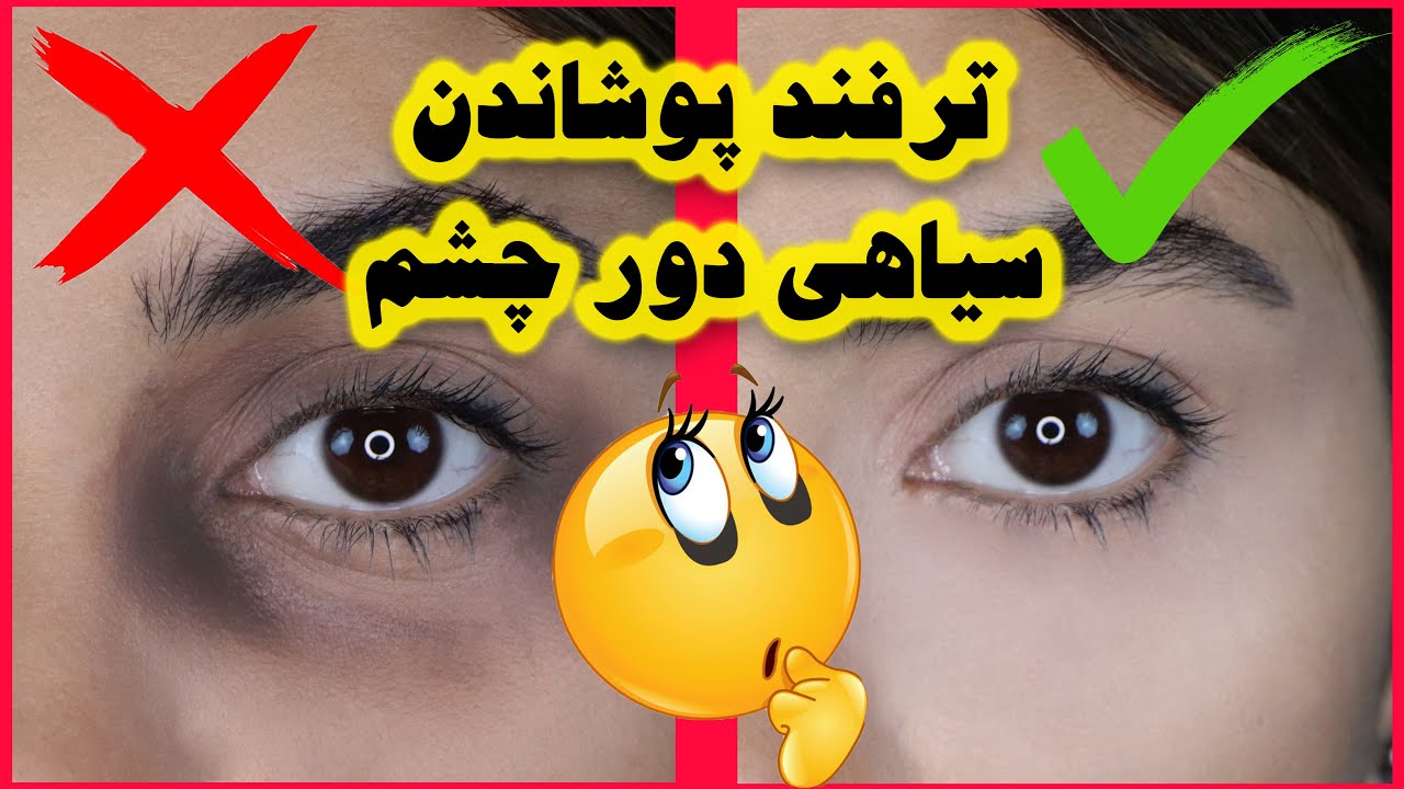 سیاهی دور چشمتو بپوشون-رفع سیاهی دور چشم با میکاپ