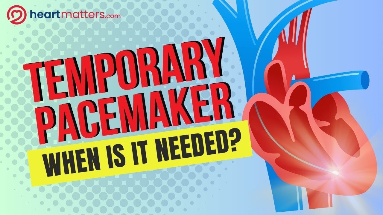 Temporary Pacemakers Explained: Life-Saving Support