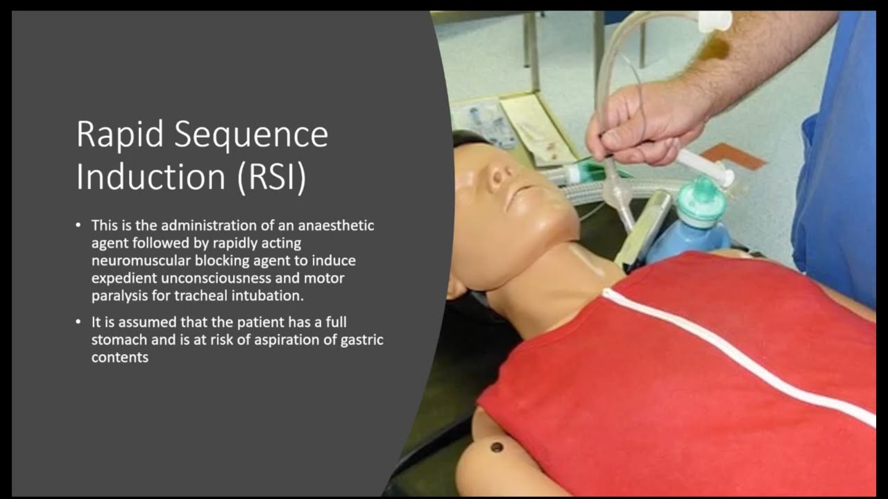 Rapid Sequence Induction