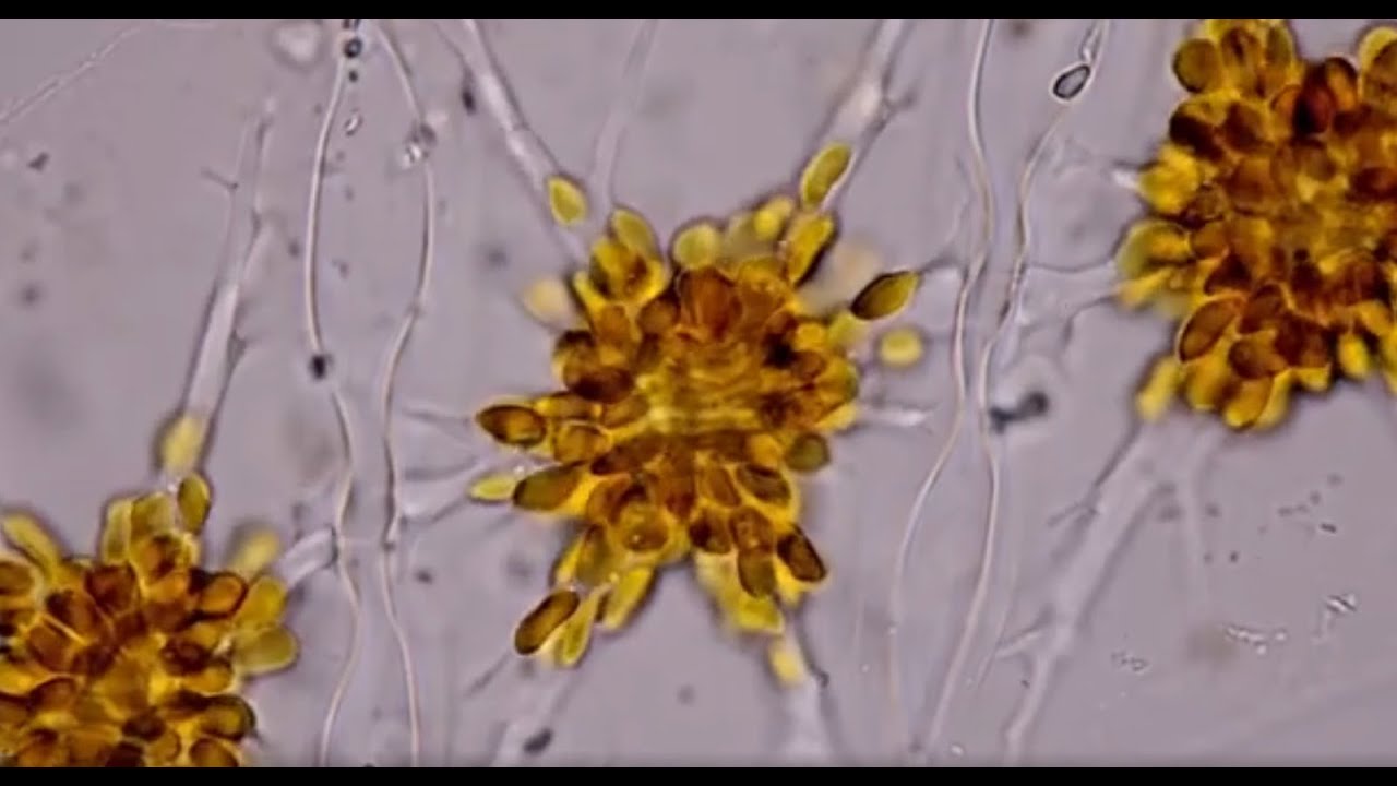 BEWARE! Eating the Wrong Fish in Fiji Could Kill You! (Fiji: The Great Astrolabe Reef)