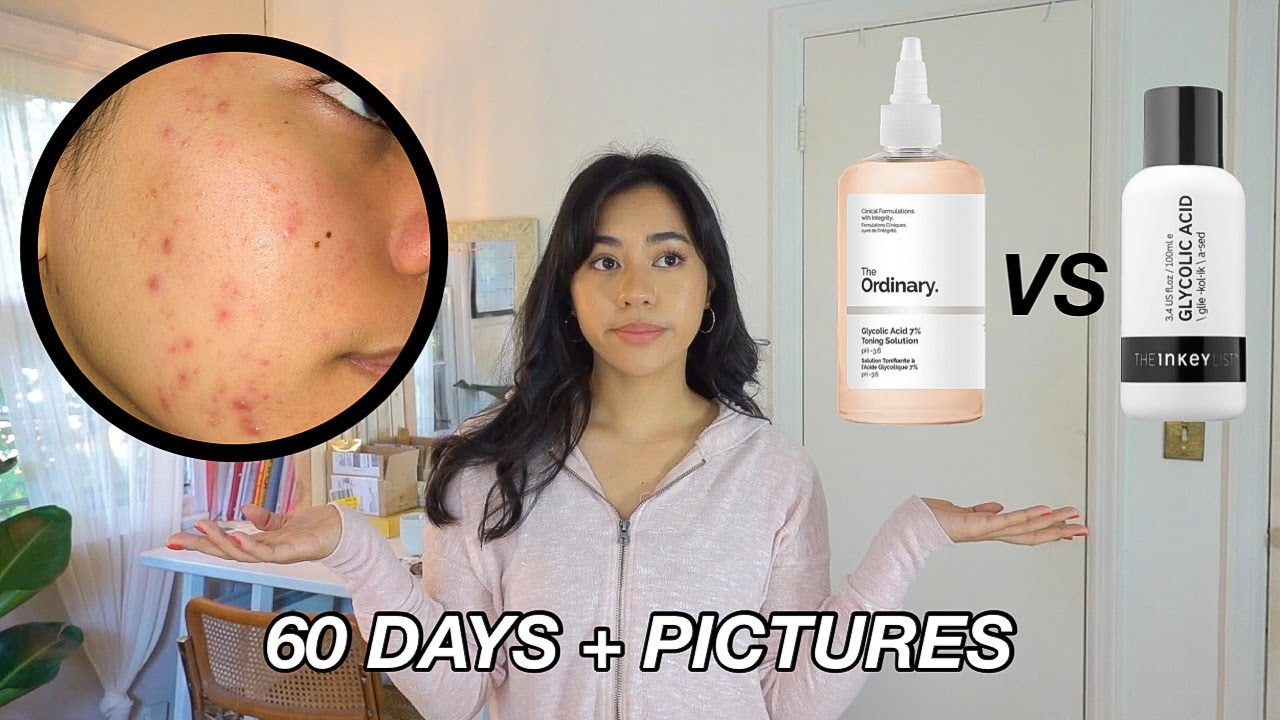 The Ordinary Glycolic Acid 7% Toning Solution VS The Inkey List Glycolic Acid Toner *60 days + pics*