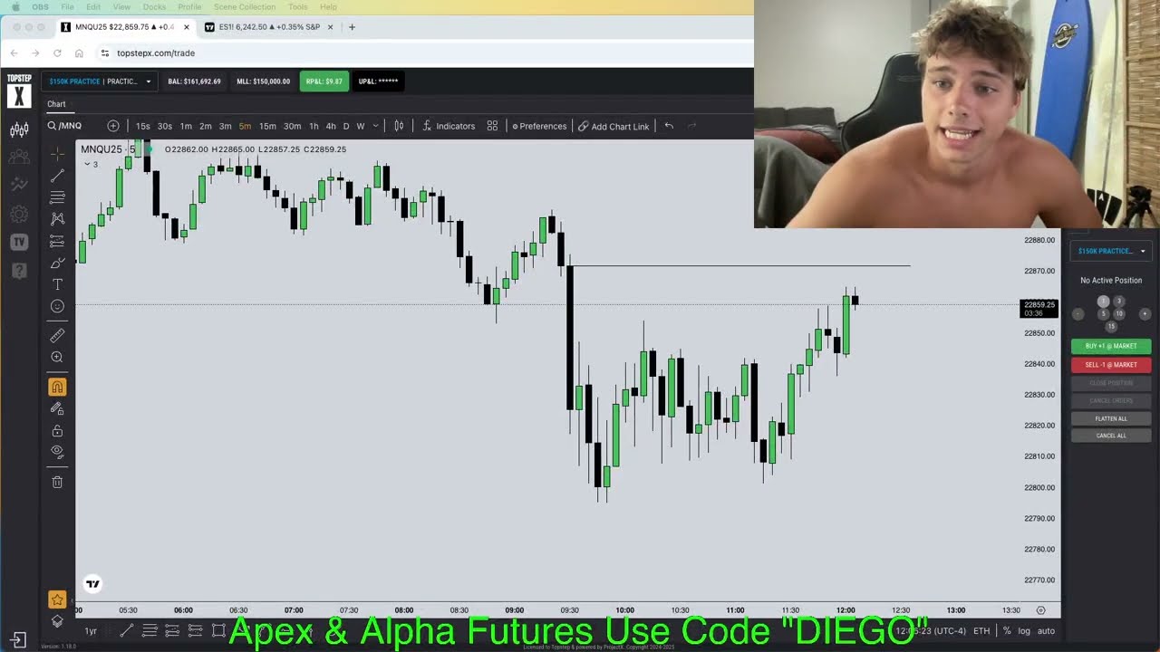 It Took 2 Years Of Trading To Understand I Don't Have To Trade Everyday