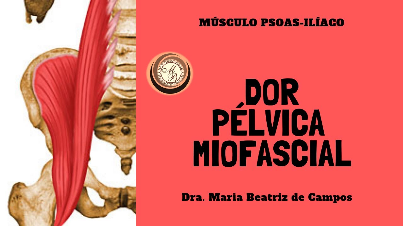 DOR PÉLVICA MIOFASCIAL - Músculo Psoas-Ilíaco