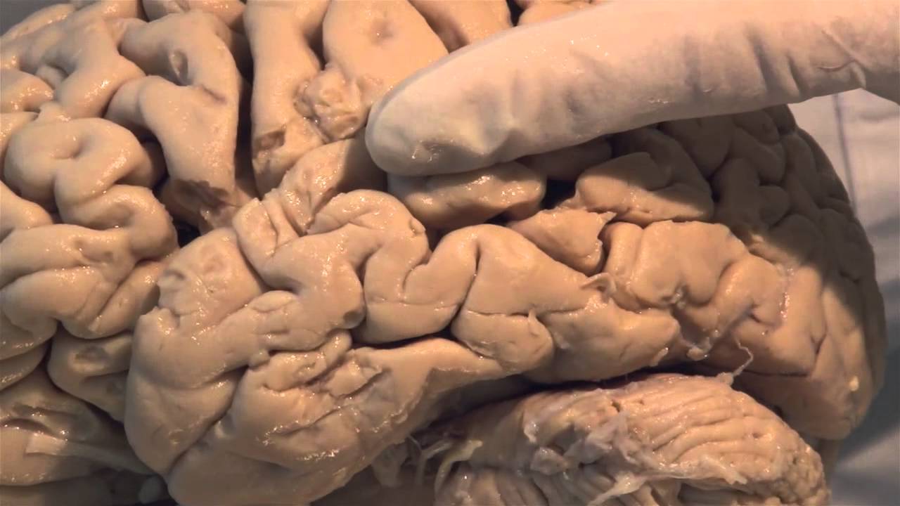 Introduction: Neuroanatomy Video Lab - Brain Dissections