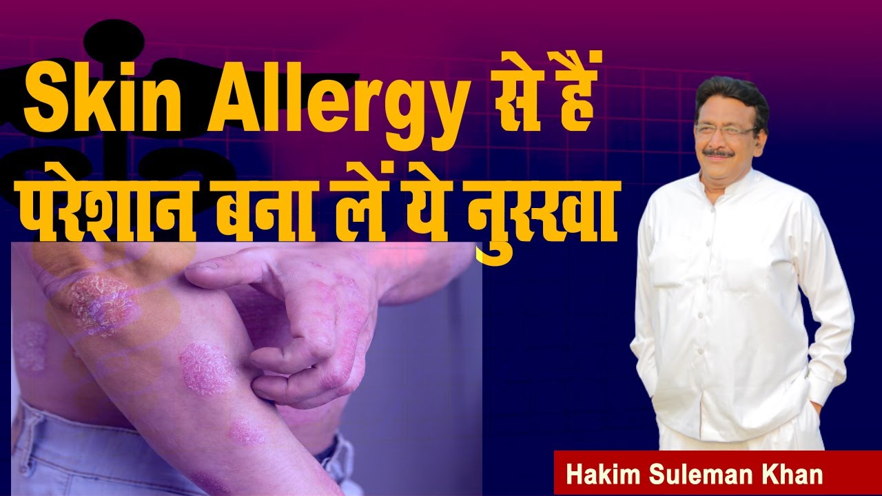 Skin Allergy से हैं परेशान बना लें ये नुस्खा। Hakim Suleman Khan | Sadhna TV