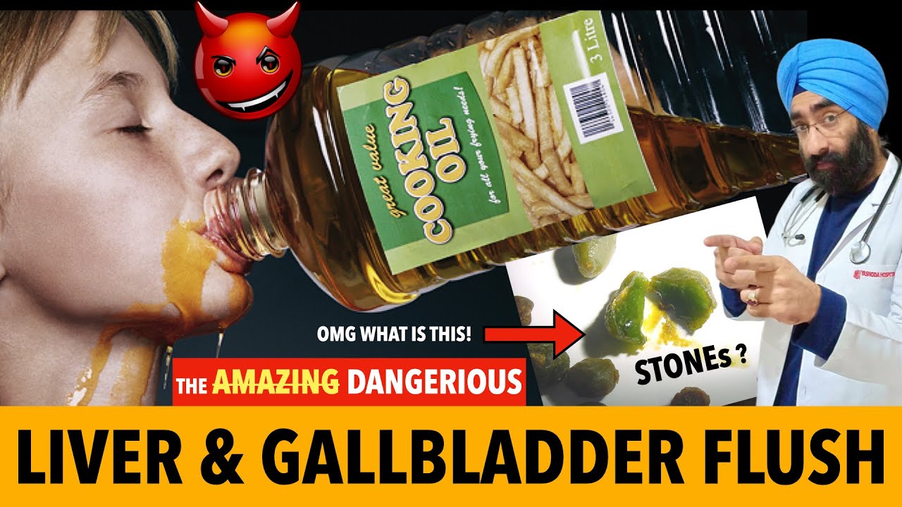 Don’t Try Epsom salt & Oil - Liver cleanse / Gall bladder Flush | Green Globules are not gallstones