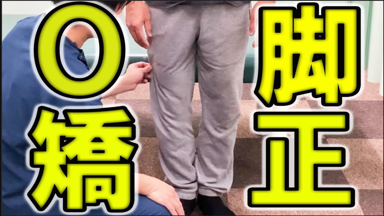 【O脚矯正　横浜市】長年のO脚を矯正してみた！横浜市青葉区のながよし整骨院