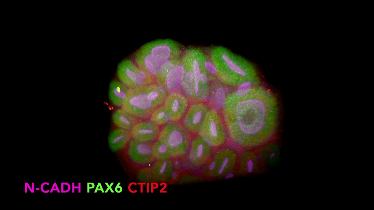 Lightsheet acquisition of a dorsal forebrain organo&iuml;d stained with N-CADH, PAX6 & CTIP2 antibodies.