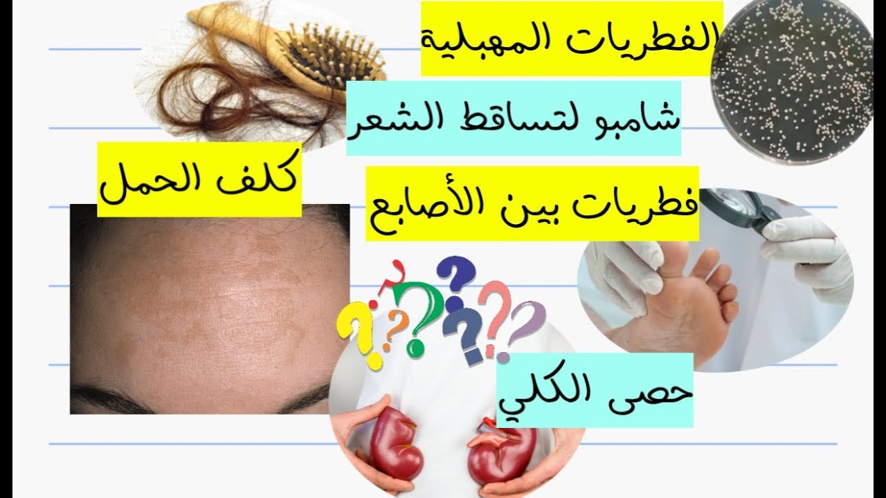 افضل شامبو لتساقط الشعر | التخلص من كلف الحمل | علاج حصى الكلي | فطريات بين الأصابع