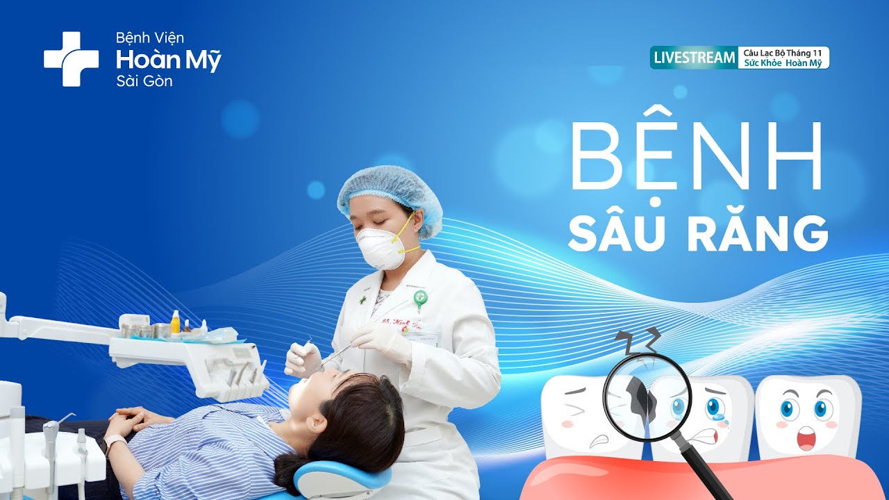 Bệnh sâu răng: phòng ngừa và điều trị | Khoa Răng Hàm Mặt - CLB Sức Khỏe Hoàn Mỹ