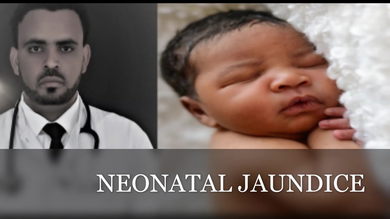 NEONATAL JAUNDICE