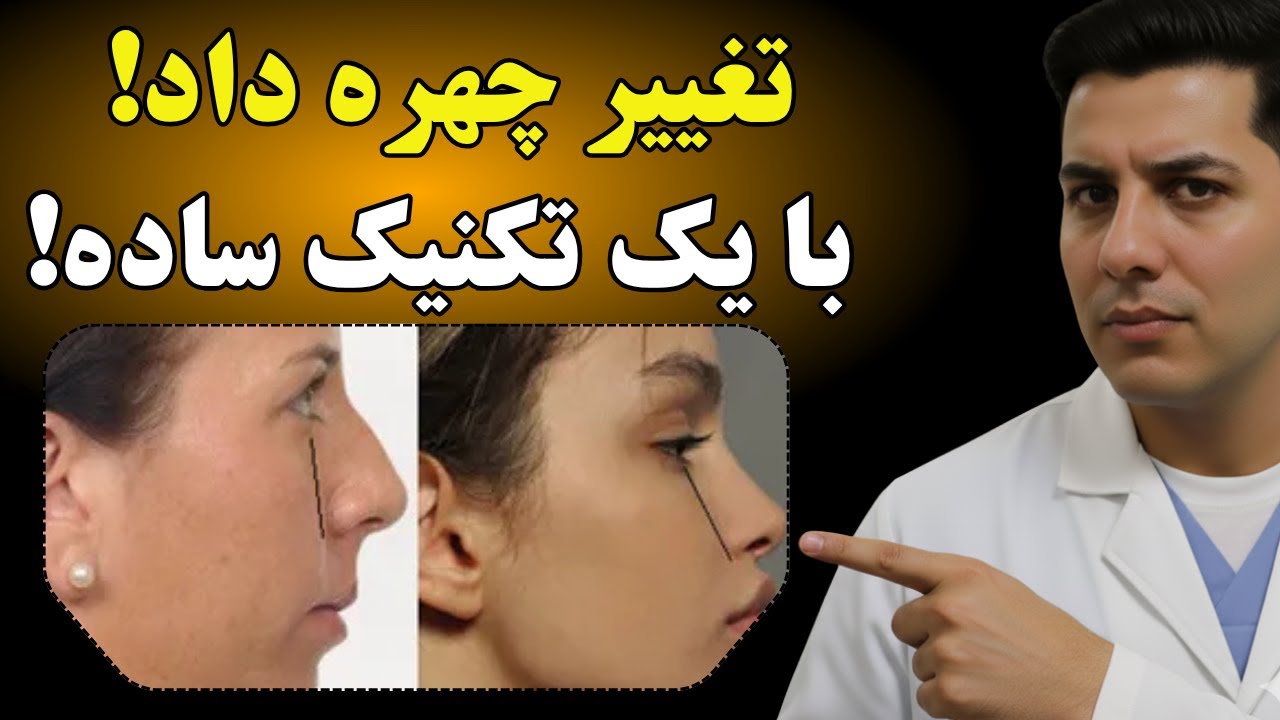 صورتی که دارید ژنتیکی نیست! راز تغییر چهره بدون جراحی با تکنیک میوینگ که به شما نمیگن!