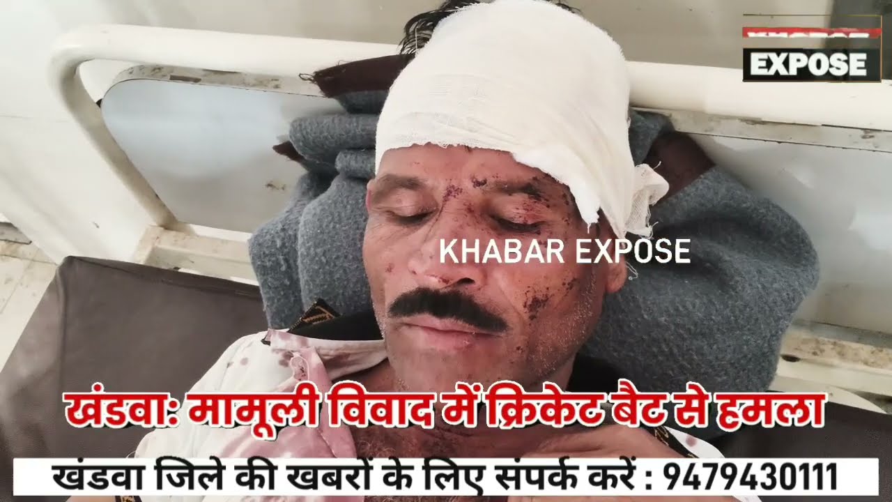 खंडवा: मामूली विवाद में क्रिकेट बैट से हमला, भंडारिया गांव की घटना, गंभीर घायल हॉस्पिटल में एडमिट