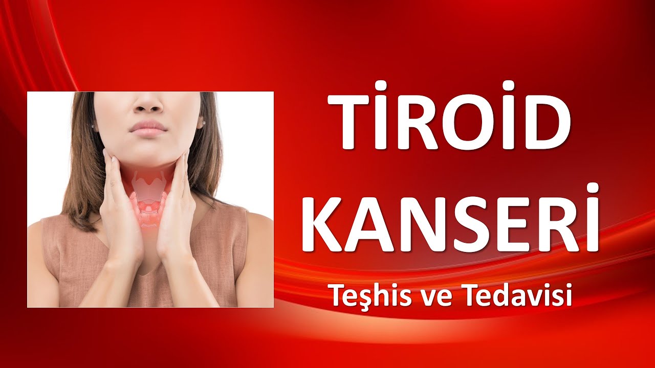 TİROİD KANSERİ Teşhis ve Tedavisi