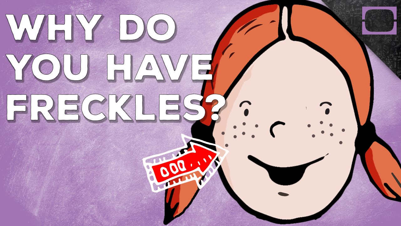 Why Do You Have Freckles?