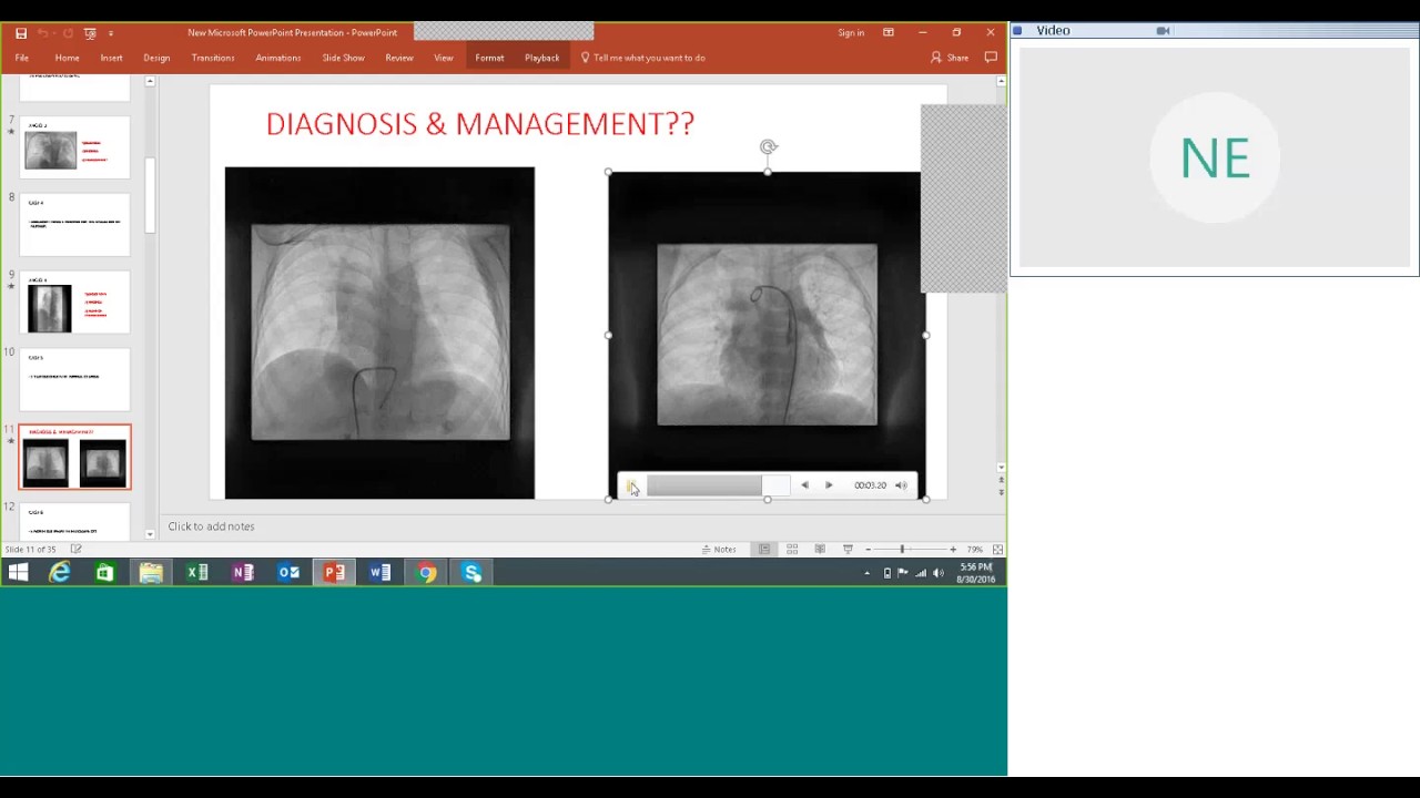 Angio quiz by Dr Biswajit Bandyopadhyay