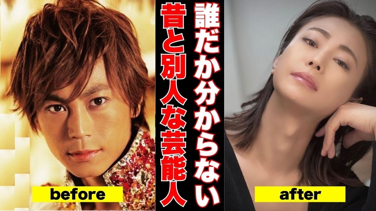 【衝撃ビフォーアフター】変わりすぎ！昔と今が別人レベルの芸能人画像【ガルちゃん芸能】