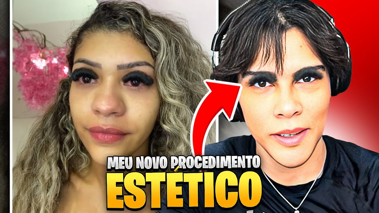 O PROCEDIMENTO EST&Eacute;TICO QUE TODO MUNDO EST&Aacute; FAZENDO!