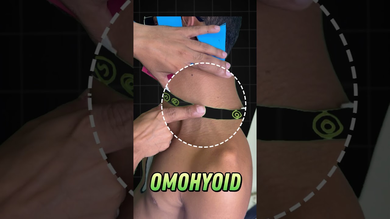 Posterior neck triangles Anatomy | Head and neck anatomy 