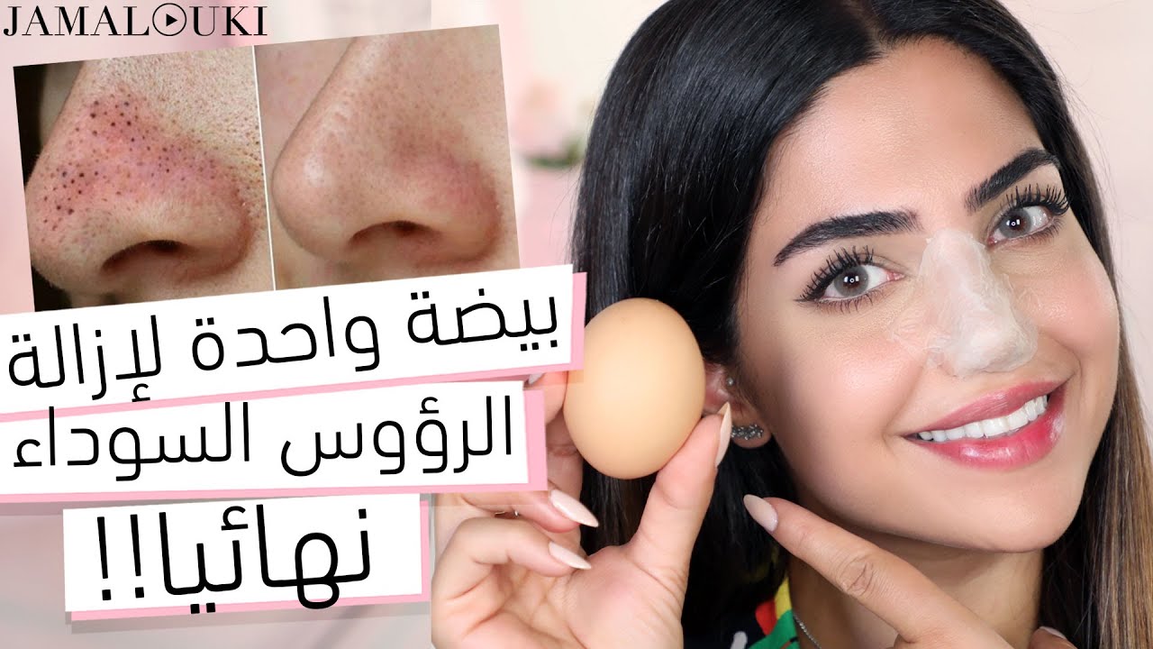 الرؤوس السوداء: ازالة الرؤوس السوداء بأبسط طريقة في المنزل
