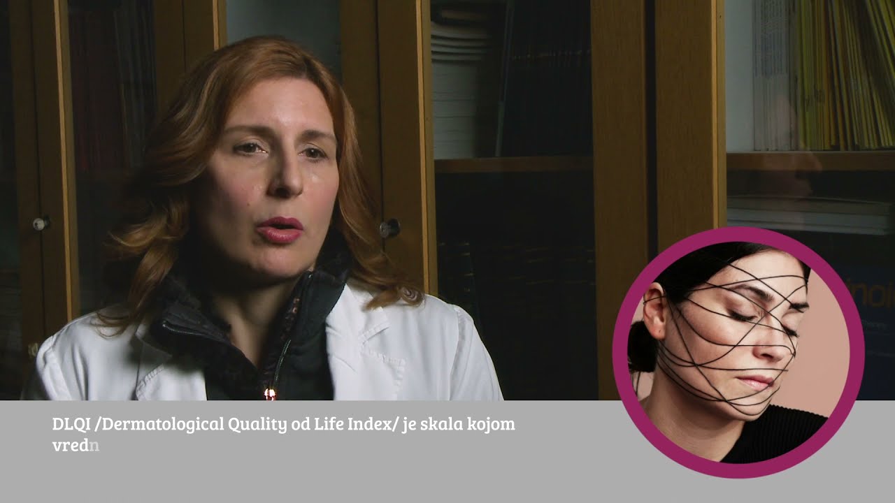 PSORIJAZA - ONLINE BAZA ZNANJA - VIDEO 5 - 