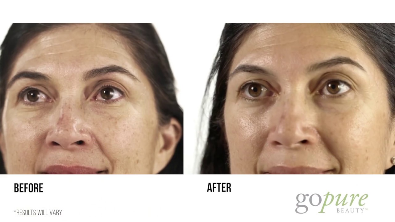 Before and After Experience with goPure!