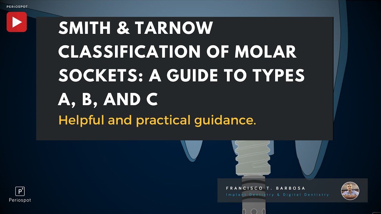 Smith & Tarnow Classification of Molar Sockets: A Guide to Types A, B, and C